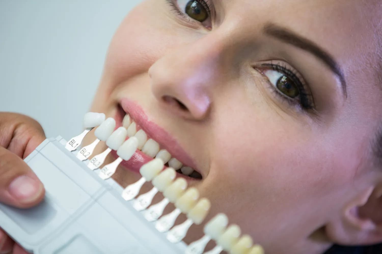 A woman compares different shades of dental veneers for her smile makeover.